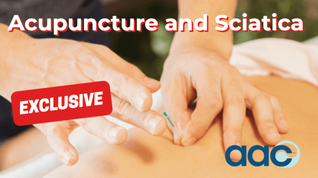 HD_Acupuncture-and-Sciatica