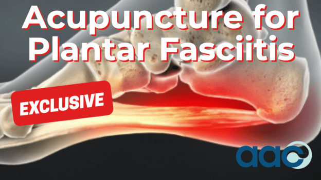 Acupuncture for Plantar Fasciitis