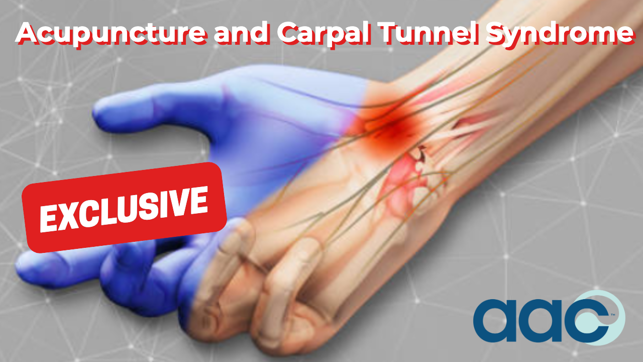 HD_Acupuncture and Carpal Tunnel Syndrome Acupuncture and Carpal Tunnel Syndrome