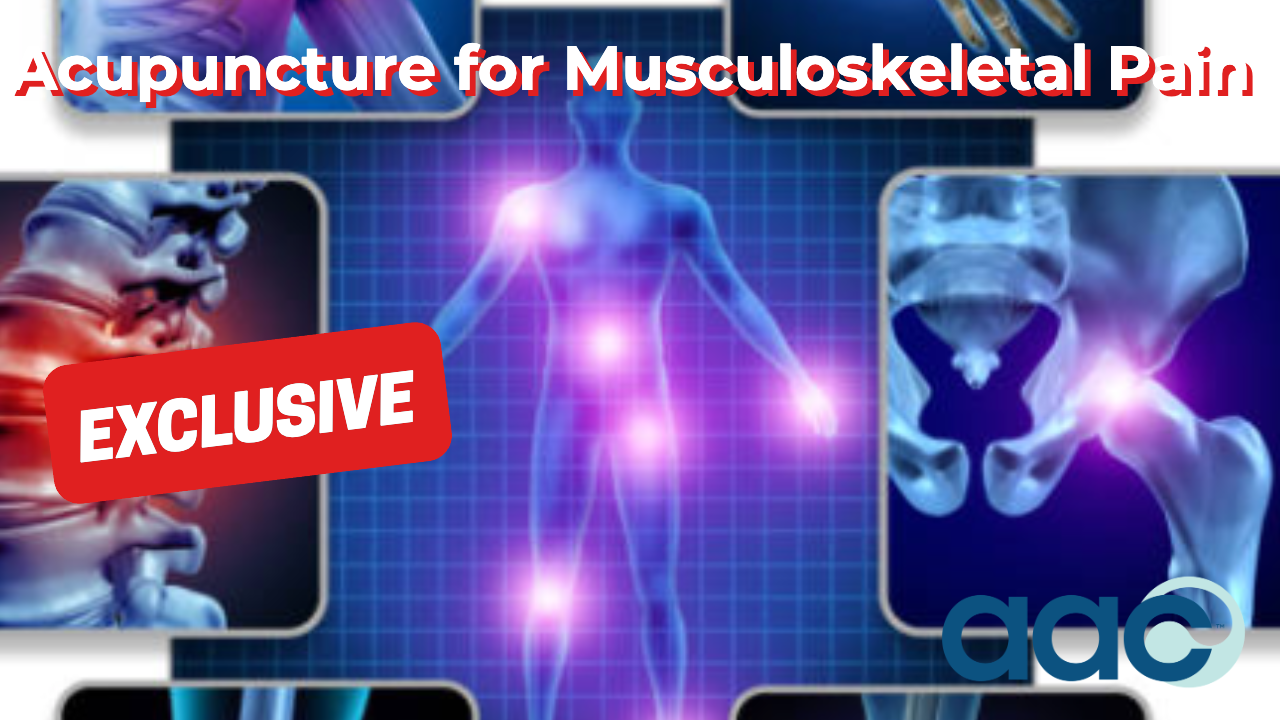 HD_Acupuncture for Musculoskeletal Pain copy Acupuncture for Musculoskeletal Pain