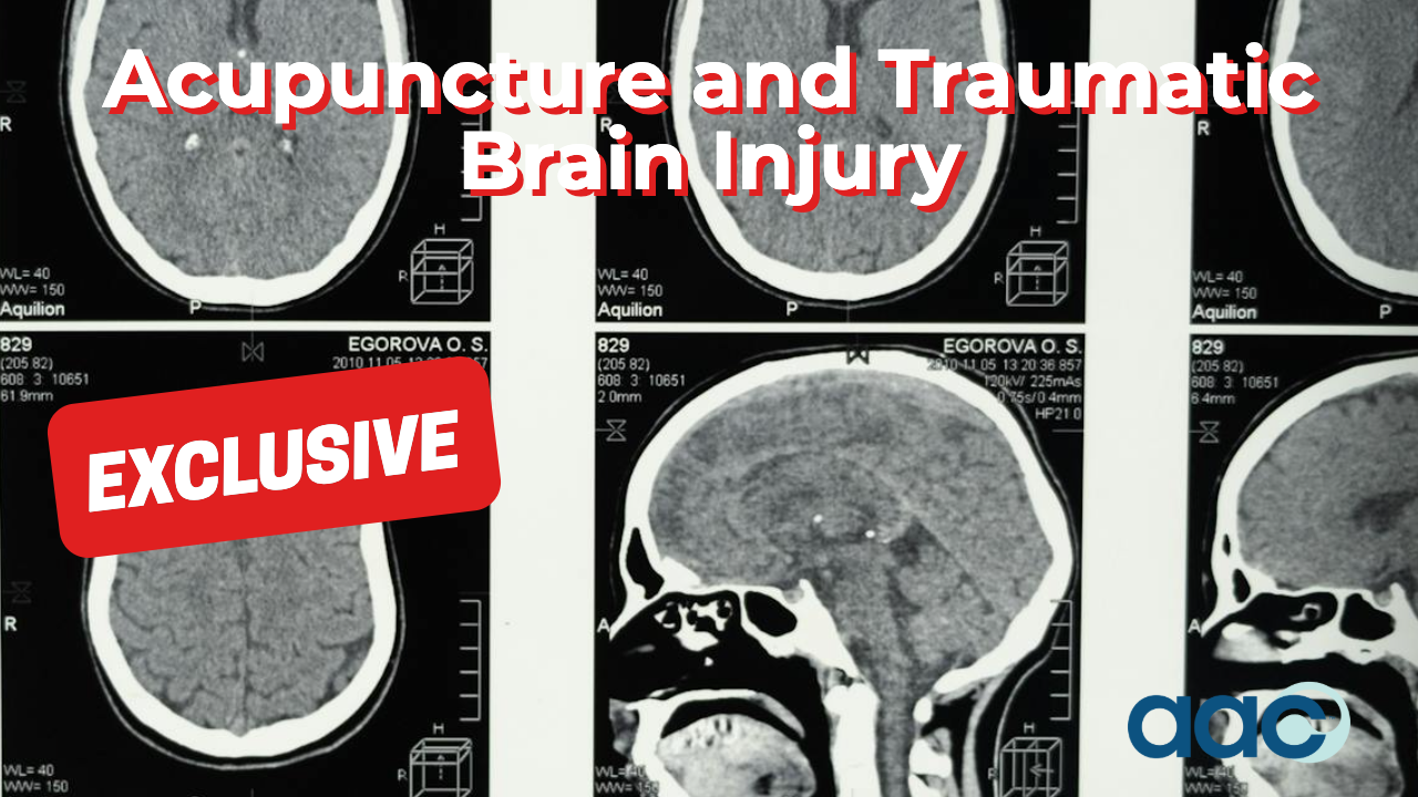 HD_Acupuncture and Traumatic Brain Injury Acupuncture and Traumatic Brain Injury