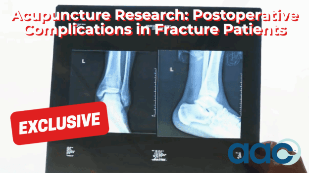 Fracture